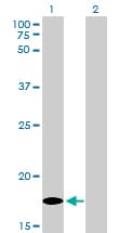 MCFD2 Antibody (clone 3A5-G4)