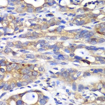 Polyclonal Rabbit anti-Human HAPLN1 Antibody (IHC, WB)