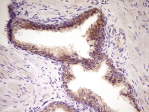 TNFRSF10B / Killer / DR5 Antibody (aa203-411, clone OTI1B9)