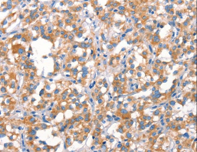 Cytochrome b Antibody