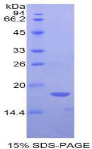 Human BMP6 Protein (Recombinant His)