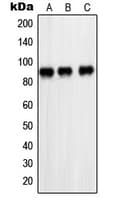 PARP1 Antibody (Internal)