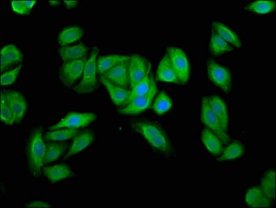 TERE1 / UBIAD1 Antibody