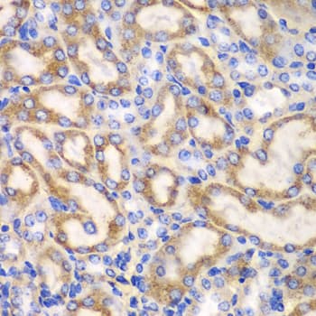 Polyclonal Rabbit anti-Human UGDH / UDPGDH Antibody (IHC, IF, WB)