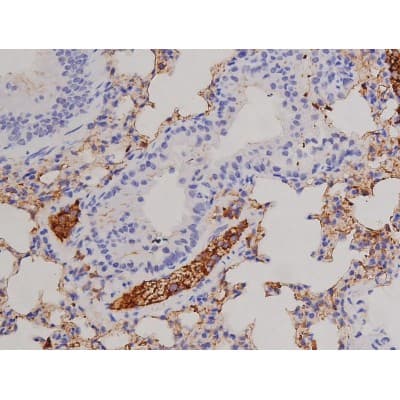 FAK / Focal Adhesion Kinase Antibody (phospho-Tyr576)
