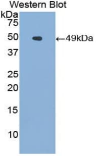 CD95 / FAS Antibody (aa22-172)