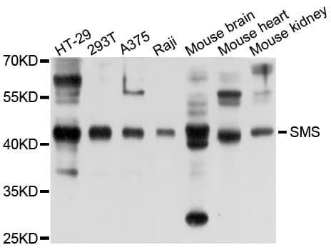 SMS / Spermine Synthase Antibody