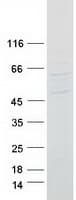 Human TPTE Protein (Recombinant Myc-DDK (Flag))