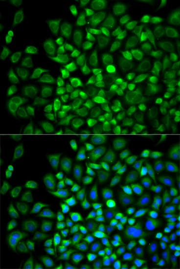 ANGPTL4 Antibody