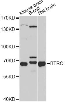 BTRCP / BETA-TRCP Antibody