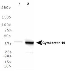 KRT19 / CK19 / Cytokeratin 19 Antibody (DY488)