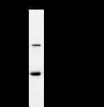 FER Antibody (clone 2358C3a)
