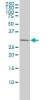 PRKAB2 / AMPK Beta 2 Antibody (clone 2G9)
