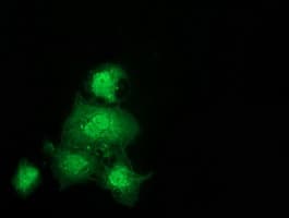 GSTT2 Antibody (clone OTI9A1)