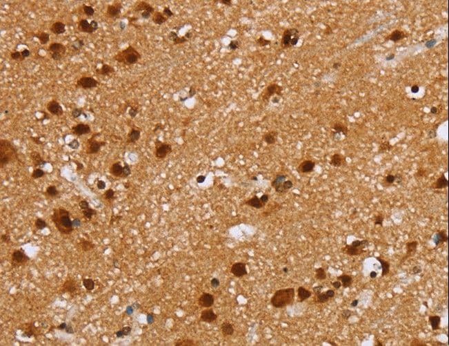 ZMAT3 Antibody