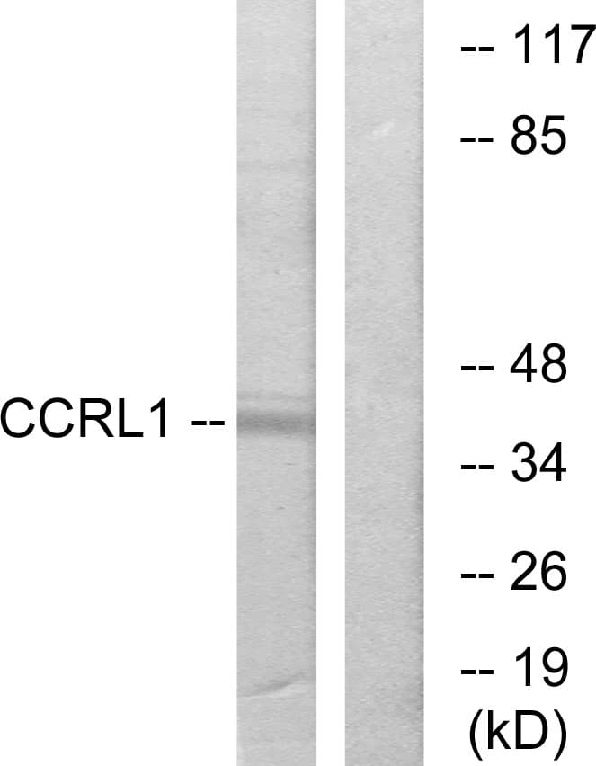 ACKR4 / CCRL1 / CCR11 Antibody (aa5-54)