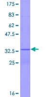 Human ERN1 / IRE1 Protein (Recombinant GST)