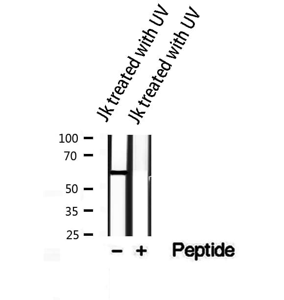 Polyclonal Rabbit anti-Human AKT1 Antibody (phospho-Tyr316,phospho-Tyr315,phospho-Tyr312, IHC, IF, WB)