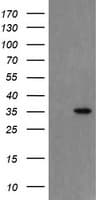 SNAI2 / SLUG Antibody (clone OTI4B3)