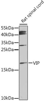 Polyclonal Rabbit anti-Human VIP Antibody (IHC, WB)