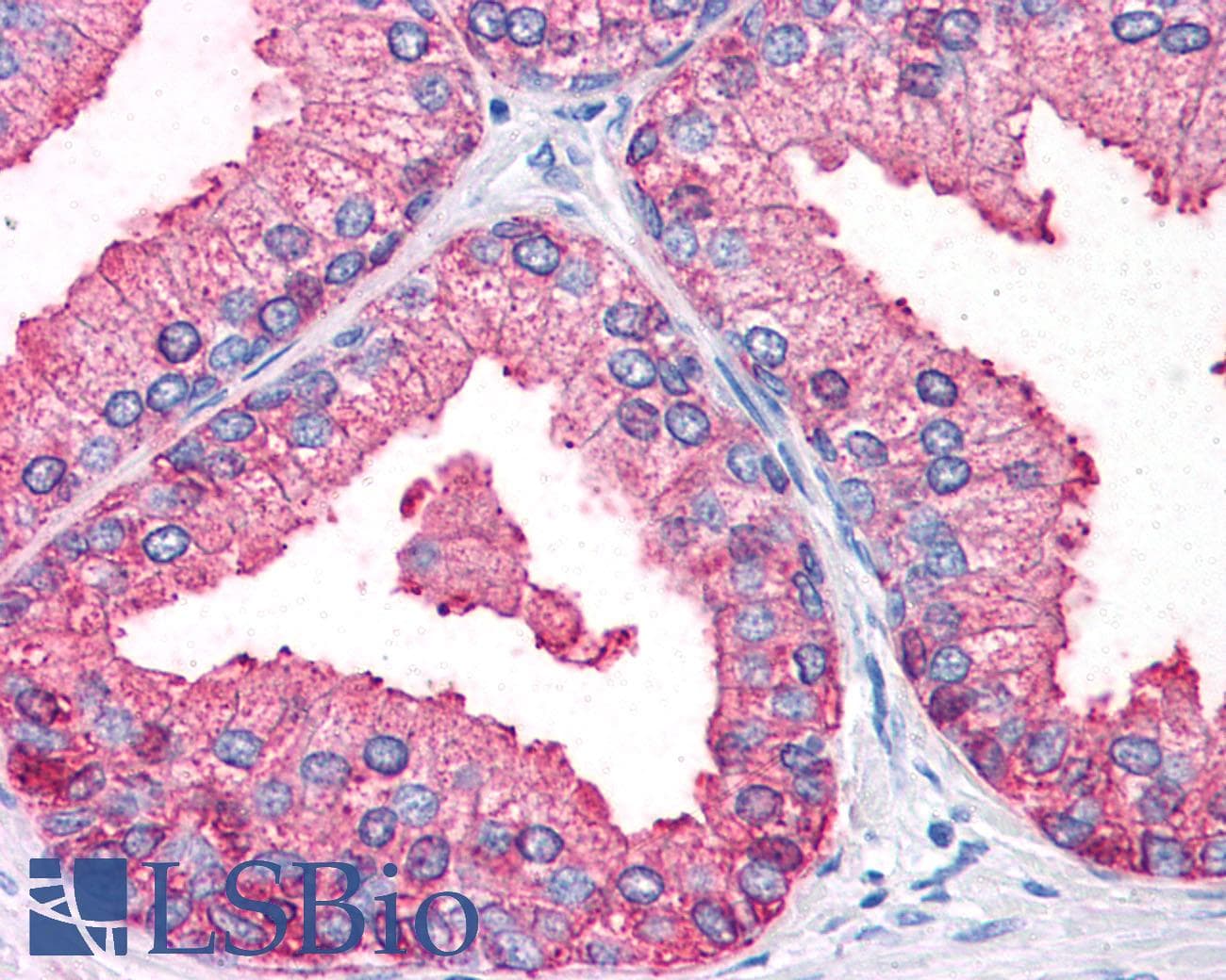 IHC-plus™ Polyclonal Rabbit anti-Human OSTC Antibody (Internal, IHC)