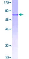 Human PRELP / Prolargin Protein (Recombinant GST)