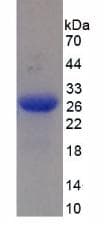 Human MASP2 / MASP-2 Protein (Recombinant His)