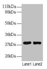 MPZ / P0 Antibody