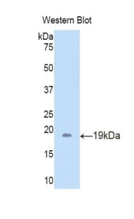 LCN6 Antibody (aa22-157)