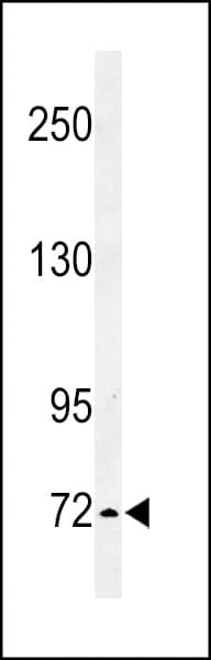 IL1RAPL2 Antibody (aa372-401)
