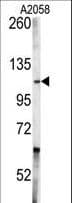 Polyclonal Rabbit anti-Human ABL1 / c-ABL Antibody (aa741-769, IHC, IF, WB)