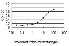 IHC-plus™ Monoclonal Mouse anti-Human STAT4 Antibody (clone 1C2-1C12, IHC, IF, WB)