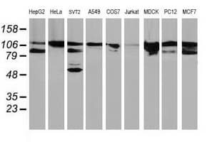 BCAR1 / p130Cas Antibody (clone OTI3A11)