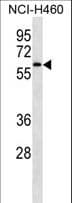 IRAK4 / IRAK-4 Antibody (aa25-52)