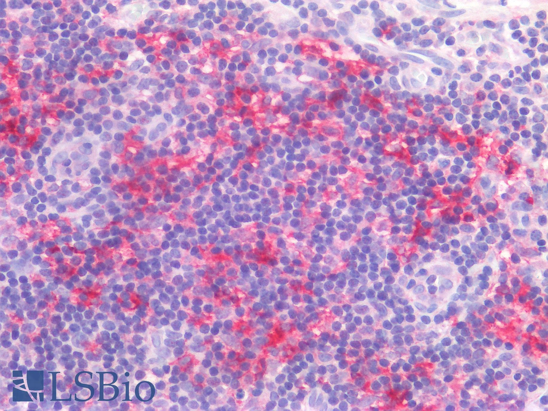 PathPlus™ Polyclonal Rabbit anti-Human DEC-205 / CD205 / LY75 Antibody (C-Terminus, IHC)