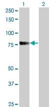 CDH6 / K Cadherin Antibody (clone 2F2)