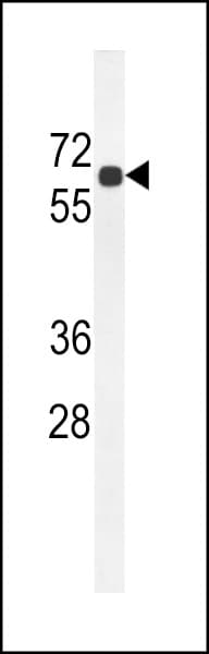 Polyclonal Rabbit anti-Human BCO2 / BCDO2 Antibody (aa71-100, WB)