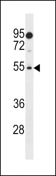 LOC391003 / PRAMEF18 Antibody (aa141-168)