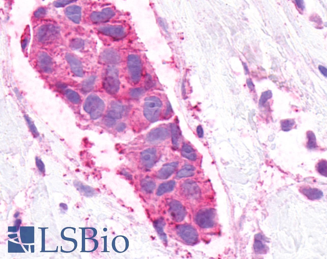 PathPlus™ GPR48 / LGR4 Antibody (N-Terminus)
