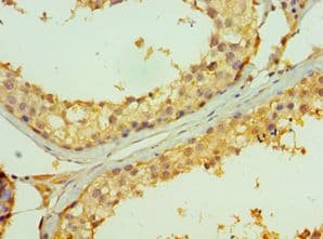 TNFRSF13B / TACI Antibody (aa184-293)