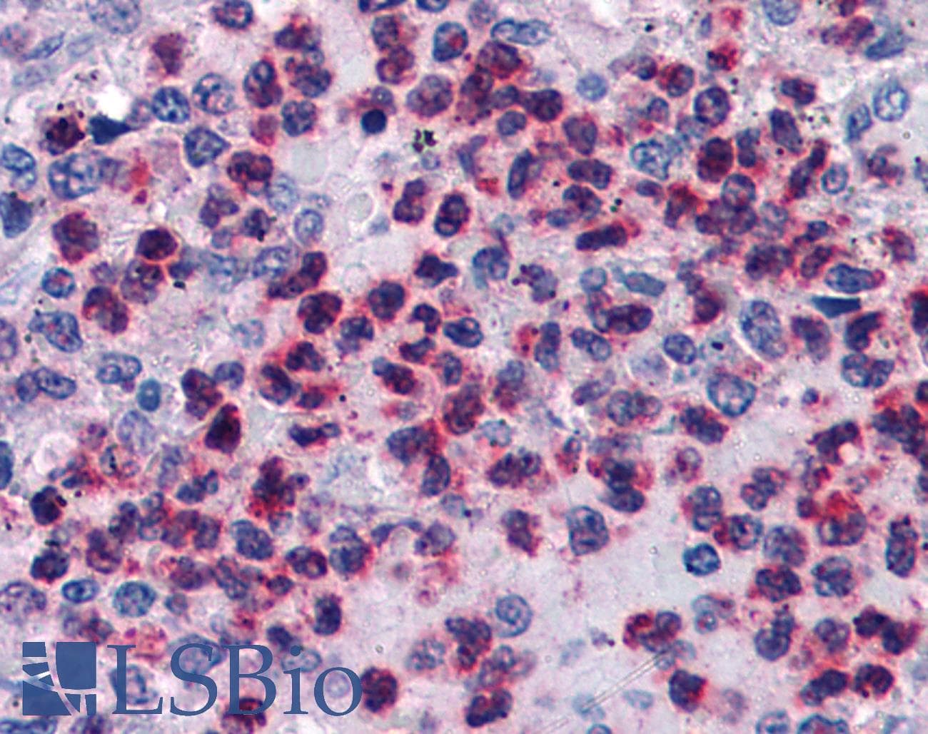 IHC-plus™ ALOX5AP / FLAP Antibody (aa148-161)