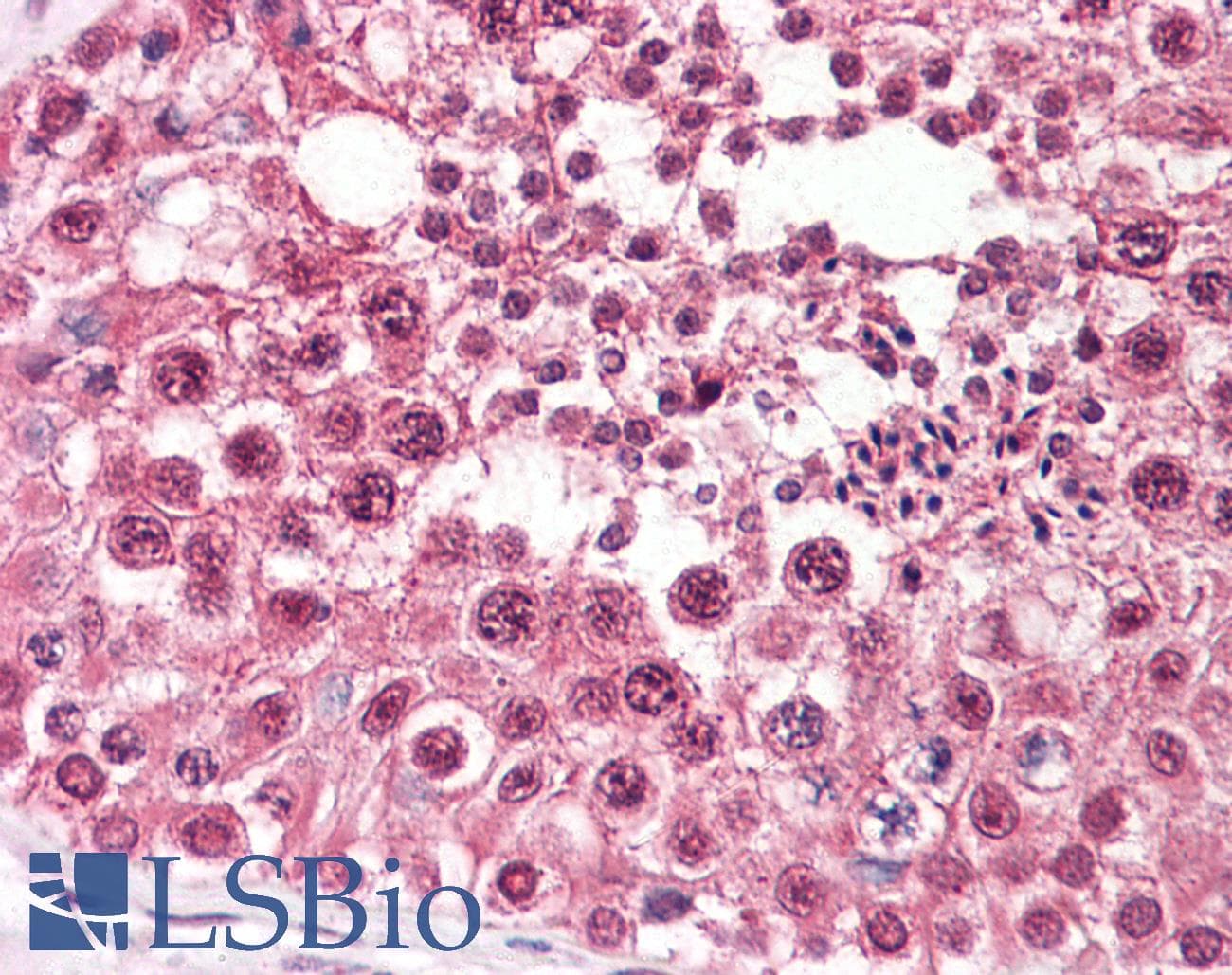 IHC-plus™ CUL1 / Cullin 1 Antibody (aa727-776)