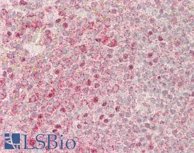 IHC-plus™ HAX-1 Antibody (clone 9F3D11)