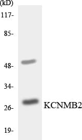 IHC-plus™ Polyclonal Rabbit anti-Human KCNMB2 Antibody (aa137-186, IHC, WB)