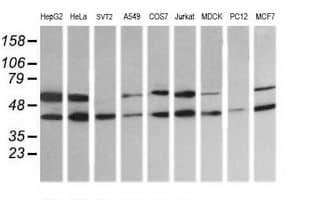 MAP2K2 / MKK2 / MEK2 Antibody (clone OTI1A2)