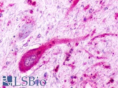 PathPlus™ C5AR2 / GPR77 / C5L2 Antibody (C-Terminus)
