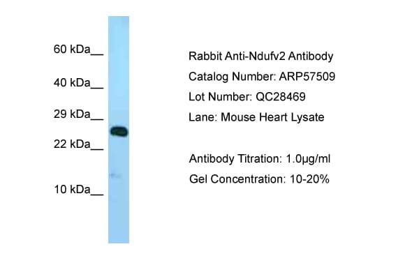 NDUFV2 Antibody (aa32-81)
