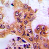 SGK1 / SGK Antibody (Internal)