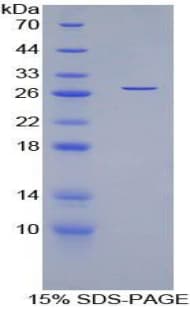Human MYOC / Myocilin Protein (Recombinant His)