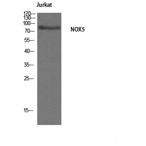 Polyclonal Rabbit anti-Human NOX5 Antibody (650-730 aa, C-terminal, IHC, WB)